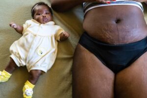 Black Mothers More Likely To Get Unnecessary C-Sections